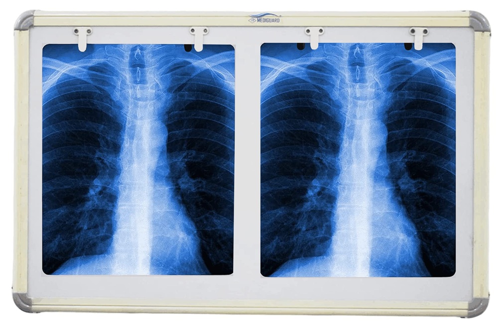 X ray Viewing Box